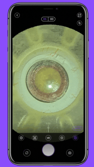 pplication tutorial adjust light, focus or color microscopic videos or picturesfor ophthalmologists or endodontics