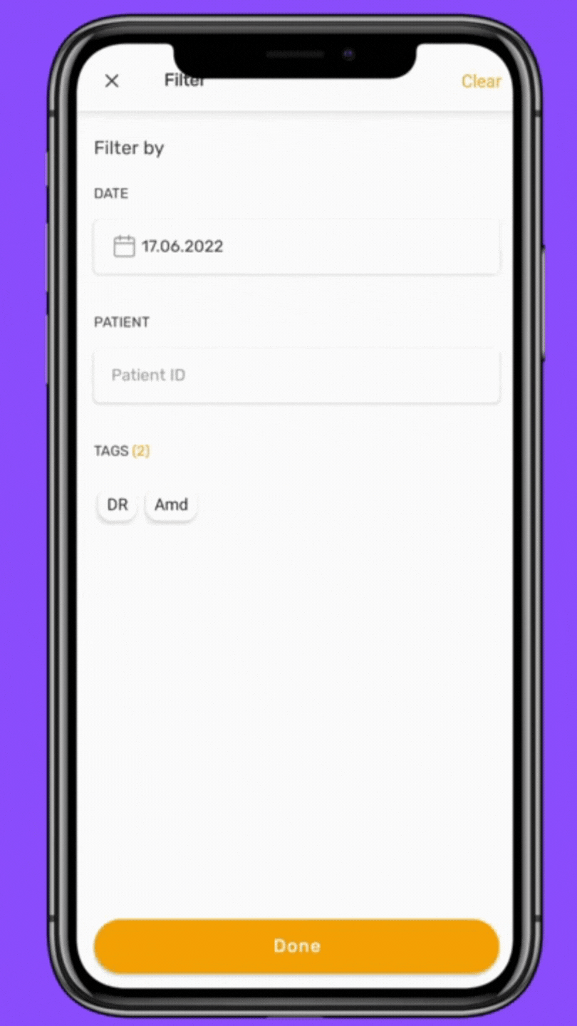 Application tutorial to add watermark on microscopic pictures for ophthalmologists or endodontics
