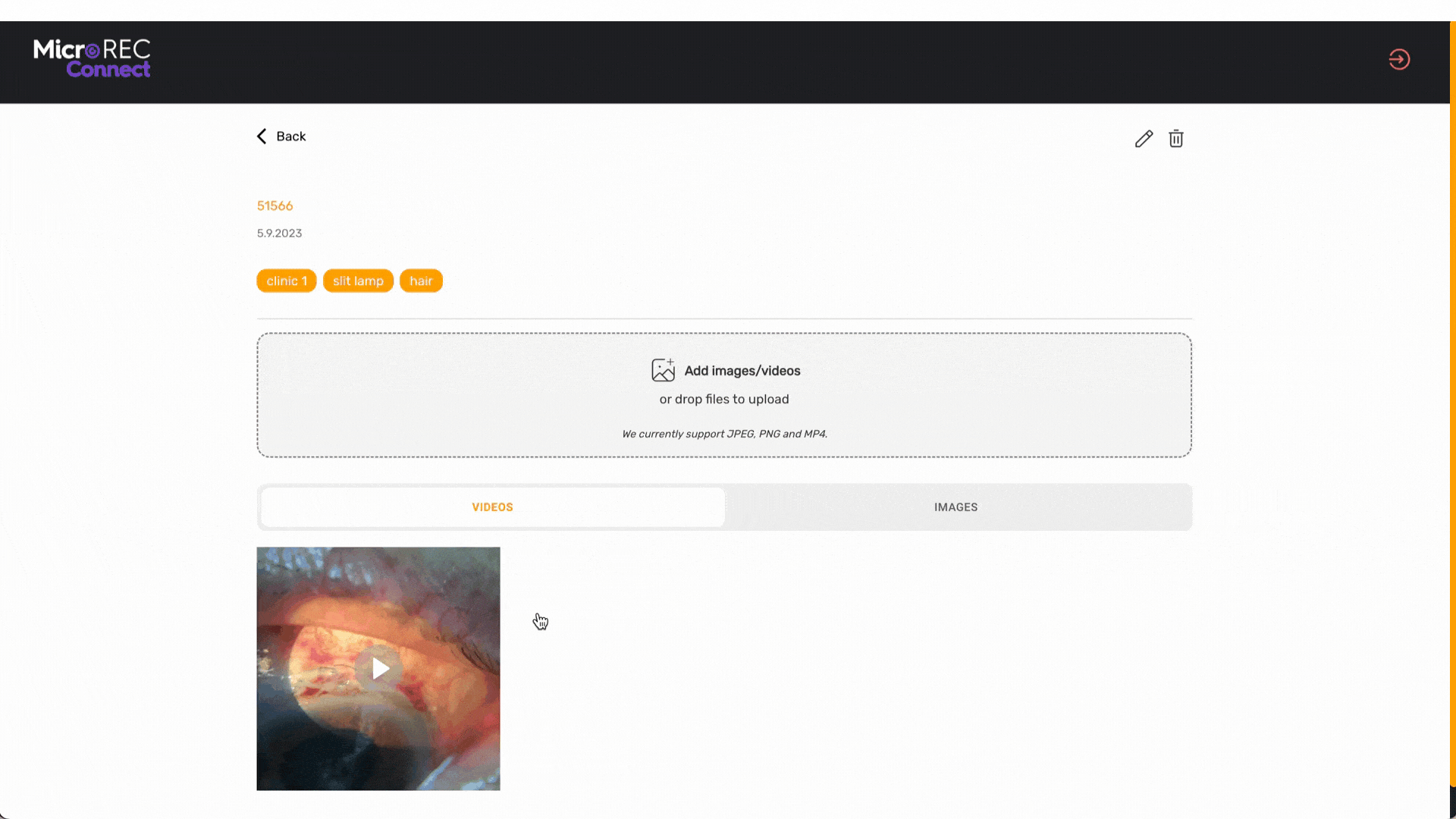 MicroREC Connect data management platform creates links to be shared instantly with patients