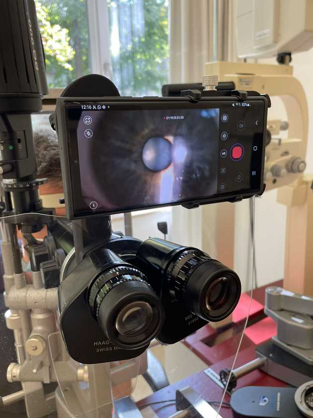 MicroREC, an optical system, attached to a slit lamp 