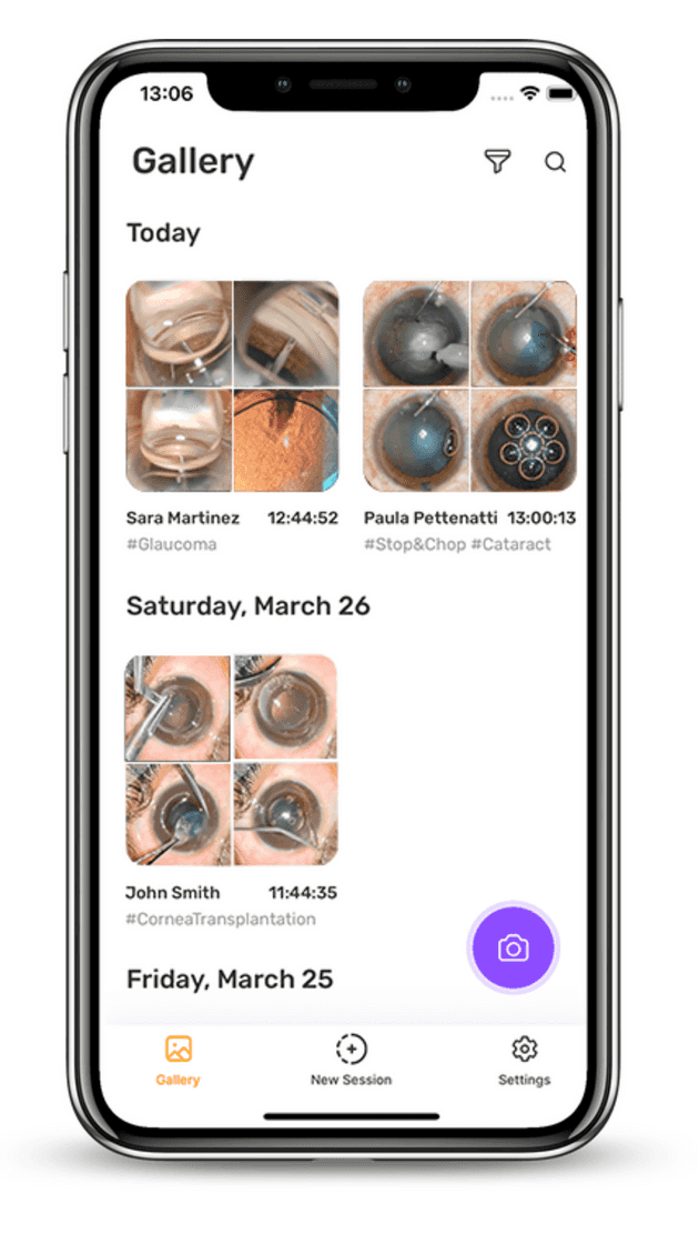 Sessions page of the application MicroREC app designed to ophthalmologists