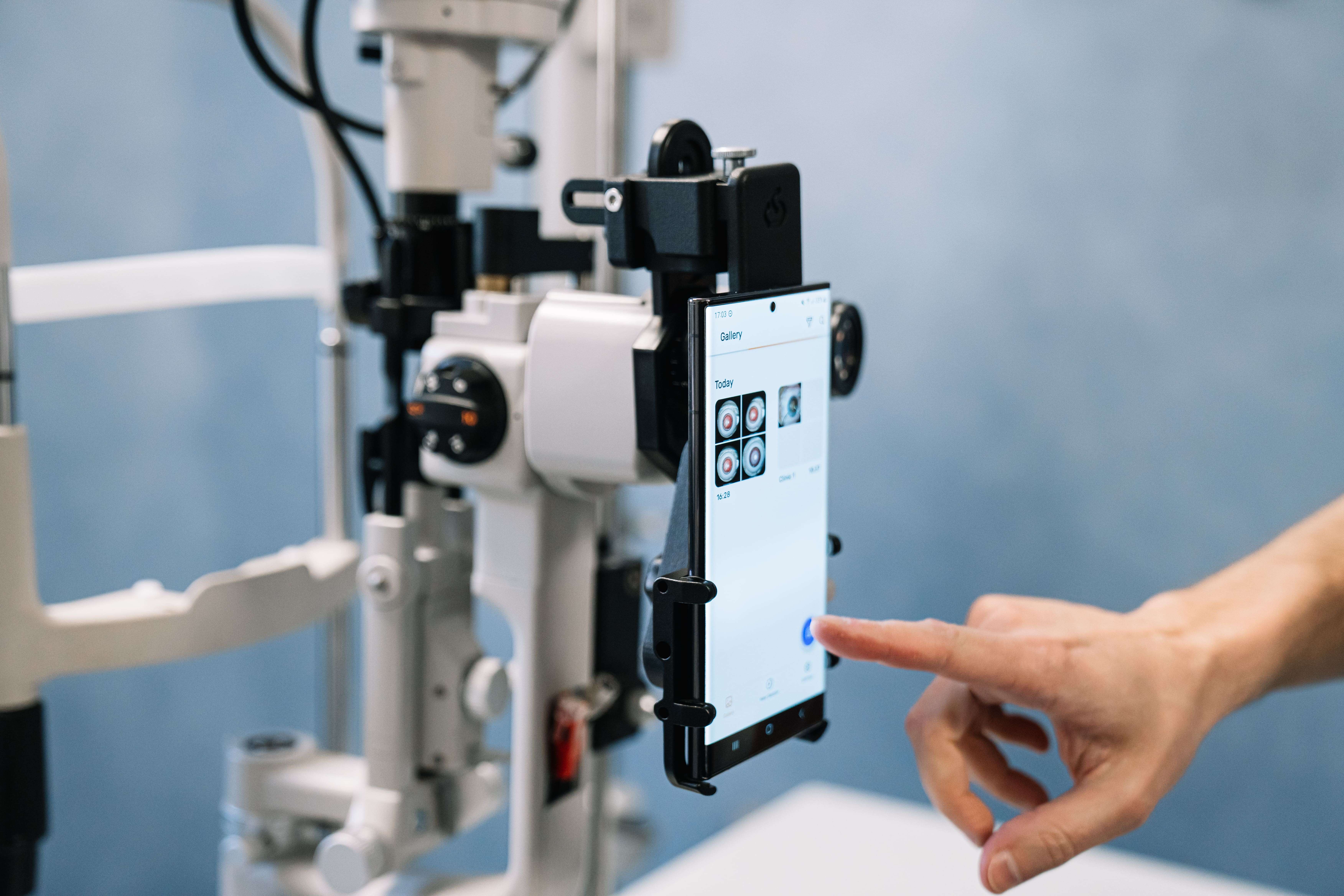 Smartphone Slit Lamp Imaging: A Study