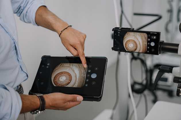 microREC app, application for ophthalmologists or any other professinal that uses microscopy to capture the bestmicroscopic image